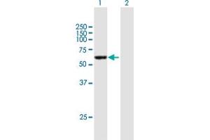 Western Blot analysis of CCDC6 expression in transfected 293T cell line by CCDC6 MaxPab polyclonal antibody. (CCDC6 anticorps  (AA 1-474))