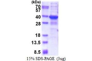 SDS-PAGE (SDS) image for TGFB-Induced Factor Homeobox 2-Like, X-Linked (TGIF2LX) (AA 1-241) protein (His tag) (ABIN5853603) (TGIF2LX Protein (AA 1-241) (His tag))