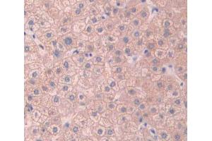 Used in DAB staining on fromalin fixed paraffin- embedded Kidney tissue (ABCB11 anticorps  (AA 421-663))