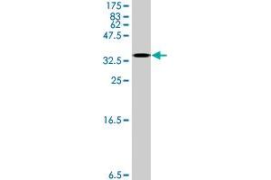 Image no. 5 for anti-Spermidine/spermine N1-Acetyltransferase 1 (SAT1) (AA 88-171) antibody (ABIN1327663)