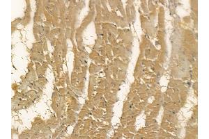 DCXR Mouse Monoclonal Antibody at 1/100 staining rat heart tissue by IHC-P. (DCXR anticorps)