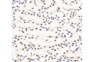 Immunohistochemistry analysis of paraffin-embedded rat kidney using,PQBP1 (ABIN7075126) at dilution of 1: 6000