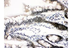 IHC testing of FFPE rat intestine with CTCF antibody.