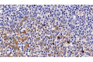 Detection of CASP3 in Human Amygdalitis Tissue using Monoclonal Antibody to Caspase 3 (CASP3)