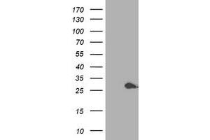 Western Blotting (WB) image for anti-Proteasome (Prosome, Macropain) Subunit, beta Type, 4 (PSMB4) antibody (ABIN1500472) (PSMB4 anticorps)