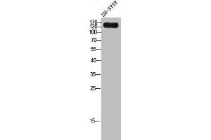 LAMC3 anticorps  (C-Term)