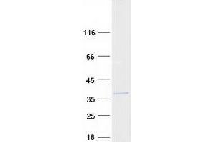 Validation with Western Blot