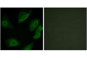 Immunofluorescence analysis of HeLa cells, using Lck (Ab-505) Antibody. (LCK anticorps  (AA 460-509))