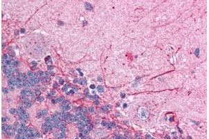 Human Brain, Cerebellum (formalin-fixed, paraffin-embedded) stained with GABRP antibody ABIN214761 at 2.