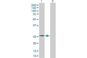 Western Blot analysis of C1QB expression in transfected 293T cell line by C1QB MaxPab polyclonal antibody.
