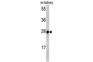 Image no. 1 for anti-Ethylmalonic Encephalopathy 1 (ETHE1) (Middle Region) antibody (ABIN452981) (ETHE1 anticorps  (Middle Region))
