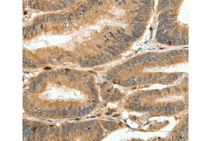 Immunohistochemistry (IHC) image for anti-S100 Calcium Binding Protein A4 (S100A4) antibody (ABIN2426858) (s100a4 anticorps)