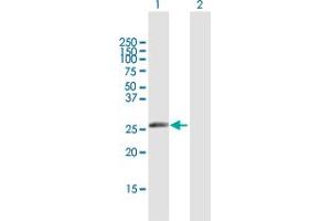 Western Blot analysis of IGKV1-5 expression in transfected 293T cell line by IGKV1-5 MaxPab polyclonal antibody. (IGKV1-5 anticorps  (AA 1-235))