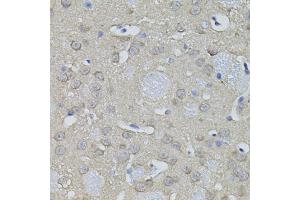 Immunohistochemistry of paraffin-embedded mouse brain using ACO1 antibody (ABIN1877037) (40x lens).