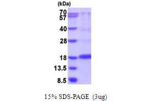 SDS-PAGE (SDS) image for Vascular Endothelial Growth Factor A (VEGFA) (AA 27-146) protein (His tag) (ABIN6387521)