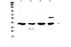 Western blot analysis of VEGFD using anti-VEGFD antibody .