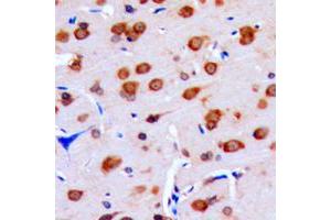Immunohistochemical analysis of DUSP16 staining in human brain formalin fixed paraffin embedded tissue section. (DUSP16 anticorps  (C-Term))