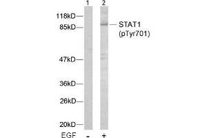 Image no. 2 for anti-Signal Transducer and Activator of Transcription 1, 91kDa (STAT1) (pTyr701) antibody (ABIN196689) (STAT1 anticorps  (pTyr701))