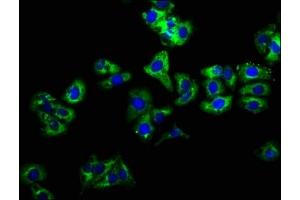 Immunofluorescence staining of HepG2 cells with ABIN7157950 at 1:166, counter-stained with DAPI.