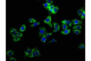 Immunofluorescence staining of HepG2 cells with ABIN7157950 at 1:166, counter-stained with DAPI. (LIME anticorps  (AA 170-295))
