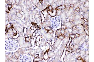 GAD65 was detected in paraffin-embedded sections of rat kidney tissues using rabbit anti- GAD65 Antigen Affinity purified polyclonal antibody (Catalog #) at 1 µg/mL.