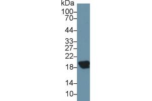 Detection of CPLX2 in Rat Cerebrum lysate using Polyclonal Antibody to Complexin 2 (CPLX2)