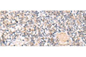 Immunohistochemistry of paraffin-embedded Human tonsil tissue using IL36A Polyclonal Antibody at dilution of 1:30(x200)