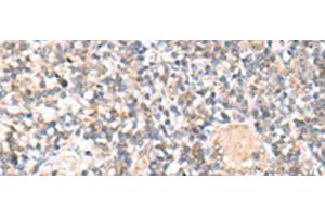 Immunohistochemistry of paraffin-embedded Human tonsil tissue using IL36A Polyclonal Antibody at dilution of 1:30(x200) (IL36A/IL1F6 anticorps)