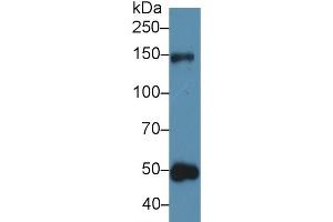 Western blot analysis of Human Urine, using Rat THBS1 Antibody (5 µg/ml) and HRP-conjugated Goat Anti-Rabbit antibody ( (Thrombospondin 1 anticorps  (AA 71-259))