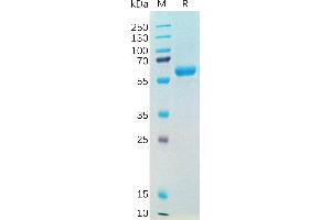 SARS-CoV-2 (2019-nCoV) S protein RBD(N501Y), hFc Tag on SDS-PAGE under reducing condition.