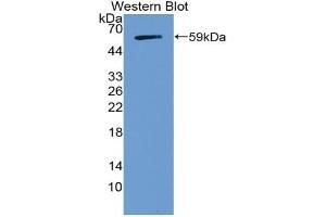 Detection of Recombinant NOTCH3, Human using Polyclonal Antibody to Notch Homolog 3 (NOTCH3) (NOTCH3 anticorps  (AA 2053-2318))