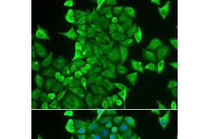 Immunofluorescence analysis of HeLa cells using CARS Polyclonal Antibody (CARS anticorps)
