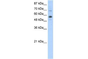 WB Suggested Anti-ZNF71 Antibody Titration:  0. (ZNF71 anticorps  (N-Term))