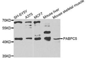 Western blot analysis of extracts of various cell lines, using PABPC5 antibody (ABIN6003706) at 1/1000 dilution. (PABPC5 anticorps)