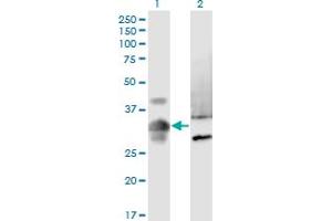Western Blot analysis of MPPED2 expression in transfected 293T cell line by MPPED2 monoclonal antibody (M08), clone 4H5. (MPPED2 anticorps  (AA 1-294))
