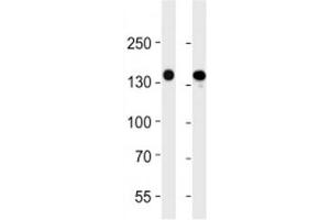 VEGFR3 antibody western blot analysis in 293 and A549 lysate.