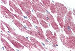 Anti-GPR15 antibody  ABIN1048732 IHC staining of human heart. (GPR15 anticorps  (Extracellular Domain))