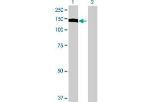 Western Blot analysis of UTP14A expression in transfected 293T cell line by UTP14A MaxPab polyclonal antibody. (UTP14A anticorps  (AA 1-771))