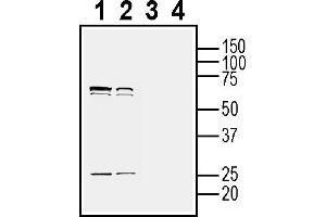 Western blot analysis of mouse  microglia cell line lysate (lanes 1 and 3) and mouse P815 mastocytoma cell line lysate (lanes 2 and 4):1-2.