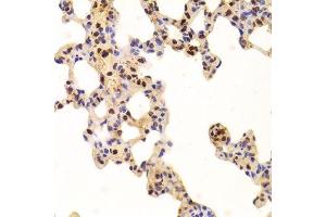 Immunohistochemistry of paraffin-embedded rat lung using ANP32A Antibody.