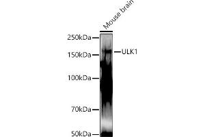 Western blot analysis of extracts of Mouse brain, using ULK1 antibody (ABIN6134005, ABIN6149921, ABIN6149922 and ABIN6224624) at 1:1000 dilution.