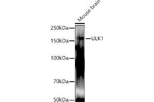 Western blot analysis of extracts of Mouse brain, using ULK1 antibody (ABIN6134005, ABIN6149921, ABIN6149922 and ABIN6224624) at 1:1000 dilution. (ULK1 anticorps  (AA 400-499))
