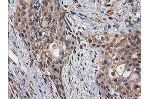 Image no. 3 for anti-Destrin (Actin Depolymerizing Factor) (DSTN) antibody (ABIN1497910) (Destrin anticorps)