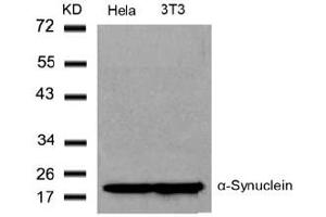 Image no. 2 for anti-Synuclein, alpha (SNCA) (Tyr136) antibody (ABIN319340)