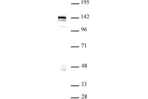 Western blot of BRD8 / SMAP2 antibody. (BRD8 anticorps  (N-Term))