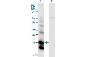 Western Blot analysis of CST6 expression in transfected 293T cell line by CST6 monoclonal antibody (M01), clone 2H8.
