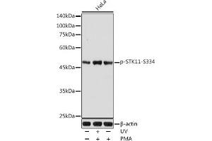 Western blot analysis of extracts of HeLa cells, using Phospho-STK11-S334 antibody (ABIN6135322, ABIN6136260, ABIN6136261 and ABIN6225618) at 1:1000 dilution. (LKB1 anticorps  (pSer334))