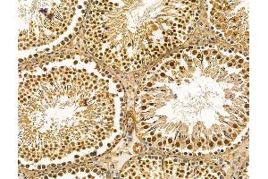 ABIN7096066 and ABIN7100128 at 1/100 staining rat testis tissue by IHC-P.