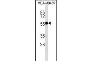 Western blot analysis in MDA-MB435 cell line lysates (35ug/lane). (ASB4 anticorps  (C-Term))