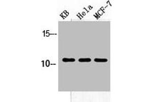 Western Blot analysis of KB HELA MCF-7 cells using SDF-1 Polyclonal Antibody